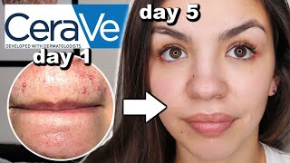 I Used CeraVe Skincare For One Week [upl. by Phillipe555]