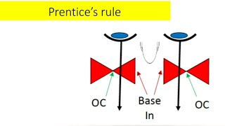 prentices rule  optical center decentration [upl. by Gaeta]