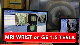 Wrist Joint MRI scan protocol positioning and planning on GE 15 Tesla  Live Demo [upl. by Rennold]