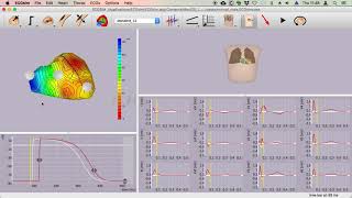 Some simple applications of ECGsim [upl. by Ennaitak]