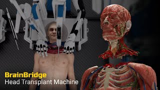 Head Transplant Machine – BrainBridge [upl. by Tesler354]