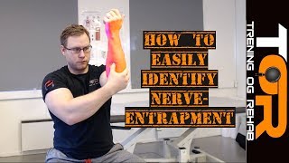 How to easily identify nerve entrapment syndromes [upl. by Annabel]