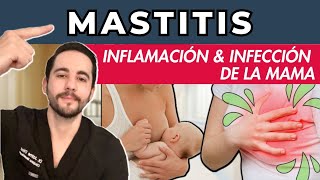 MASTITIS  Inflamación e Infección de la Mama  Qué es Lactancia Causas Tratamiento [upl. by Bohaty66]