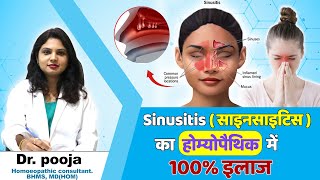 Sinusitis  साइनसाइटिस  का होम्योपैथिक में 100 इलाज   Health Plus  Sinusitis treatment [upl. by Nwahs]