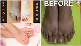 How to Clean Feet at Home  Pedicure and Manicure at Home [upl. by Nealy]