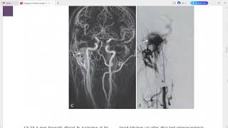 BRAIN IMAGING EXPERT RADIOLOGY SERIES [upl. by Ahsaenat]