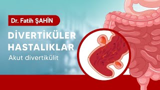 DİVERTİKÜLER HASTALIKLAR  Dr Fatih Şahin Anlatıyor [upl. by Kiersten]