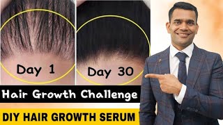 Powerful Hair Growth Serum For Extreme Hair Growth  Regrow Lost Hair Get Double Density in 30 days [upl. by Enoj]