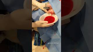 How to surgically fix a canine ear hematoma by a veterinarian [upl. by Ennoval]