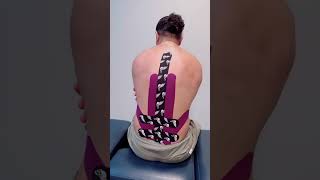 ATHLETIC TAPING FOR LOW BACK PAIN🩹 [upl. by Yednarb420]