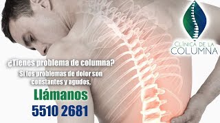 Problema de columna desviada 🏥 escoliosis lumbar [upl. by Mayworm]