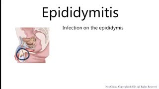 Epididymitis [upl. by Rodie]