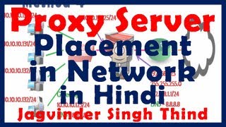 ✅ Placement of Proxy Server in Network in Hindi [upl. by Suzanne439]