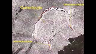 CementumPeriodontium 1 [upl. by Yleme464]