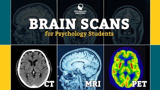 BRAIN SCANS FOR PSYCHOLOGY STUDENTS  CT MRI fMRI PET  Neuroscience [upl. by Hussey]