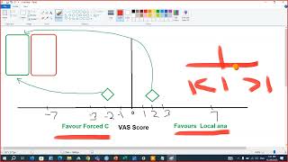 Position of Intervention and Control On MetaAnalysis Forest Plot [upl. by Hauhsoj]