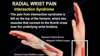 Wrist Paincauses and treatmentPart 2  Everything You Need To Know  Dr Nabil Ebraheim [upl. by Franciska]