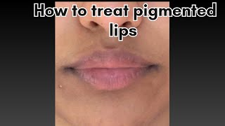 Lip pigmentation solution skincareroutine lipbalm lipcare [upl. by Cecilia]