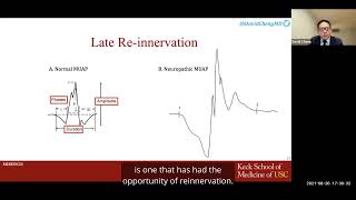 Role of Electrodiagnostic Testing in Spine Care [upl. by Louisa]