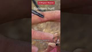 REMOVAL OF WICKED SPLINTER 😳shorts splinter [upl. by Sokram]