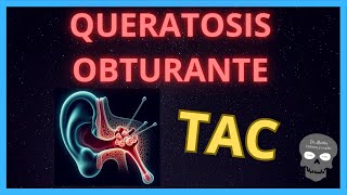 QUERATOSIS OBTURANTE en TOMOGRAFÍA 👂 [upl. by Carleton]