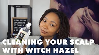 Loc Talk 27  Quarantine Loc Maintenance  Cleaning Your Scalp with Witch Hazel [upl. by Oigroeg779]