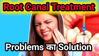 Why Root Canal Treatment Fails  5 Shocking Root Canal Treatment Secrets Your Dentist Wont Tell You [upl. by Ytisahcal]