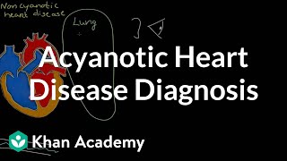 Acyanotic heart disease diagnosis  Circulatory System and Disease  NCLEXRN  Khan Academy [upl. by Delilah729]