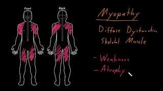 Syndrome Myopathy [upl. by Milon]