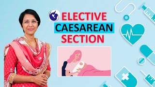 What is Elective C Section Cesarean section – Dr Rajeshwari Reddy Explains [upl. by Samuela]