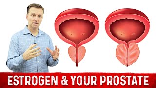 How To Fix Enlarged Prostate Explained By Dr Berg [upl. by Ellehcin]