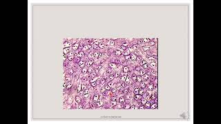 Histology Slides Series Episode 4  Cartilages and Bone [upl. by Navoj58]