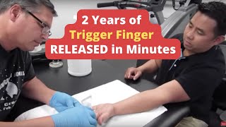 2 Years of  Trigger Finger  RELEASED in Minutes REAL RESULTS [upl. by Ecyarg999]