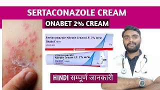 Sertaconazole cream in hindi  Onabet cream  Sertaconazole ointment [upl. by Alecia]