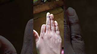 Four fingers 😁😁shortvideo comedy trending [upl. by Loux]