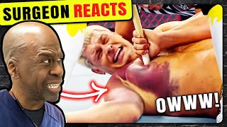 20 Minutes Of Insane WWE Injuries  Surgeon Reacts [upl. by Nonnair]