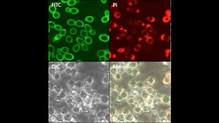 Antifungal Activity and Action Mechanism of Histatin 5Halocidin Hybrid Peptides against Candida ssp [upl. by Finn]