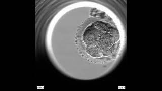 Blastocyst seen with EmbryoScope [upl. by Bihas]