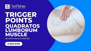 Trigger Point Release  Quadratus Lumborum [upl. by Enilra863]