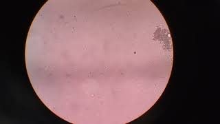 Normozoospermia amp Oligozoospermia semen slide under the microscopy 40x [upl. by Nido]