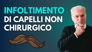 Infoltimento di capelli non chirurgico [upl. by Ricca]