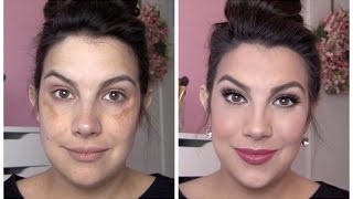 FULL COVERAGE Makeup for Melasma amp Discoloration [upl. by Rihsab]