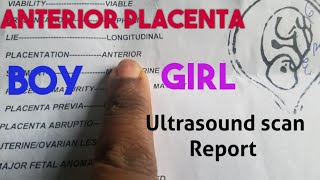 Anterior Placenta Baby GenderUltrasound Scan Report [upl. by Tews301]