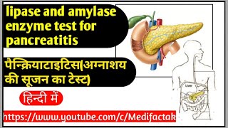 Lipase and amylase enzymes test for pancreatitisपैन्क्रियाटाइटिसअग्नाशय की सूजन का टेस्ट [upl. by Ten]