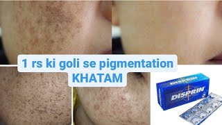 1 rs mein pigmentation GAAYAB [upl. by Odnavres]