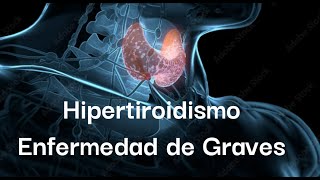 hipertiroidismo en la Enfermedad de Graves Resumen para USMLE [upl. by Nosac]