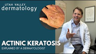 Actinic Keratosis Explained by a Dermatologist  Utah Valley Dermatology [upl. by Efron]