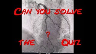 What are the Patient´s problems Echocardiography and Coronary angiogram Quiz by Cardiology Forum [upl. by Leinad]