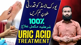 Uric Acid Treatment  Natural Remedies for GOUT Get Rid of Hyperuricemia [upl. by Berriman]