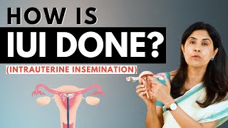 How is IUI done Dr Anjali Kumar  Maitri [upl. by Dov]